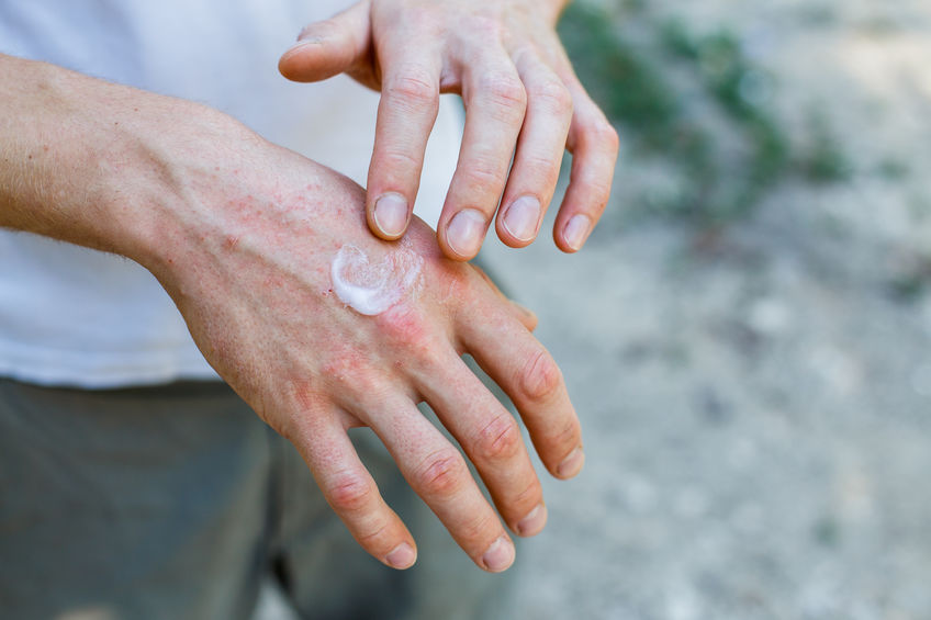 Why do I have a skin rash? | AlliApp
